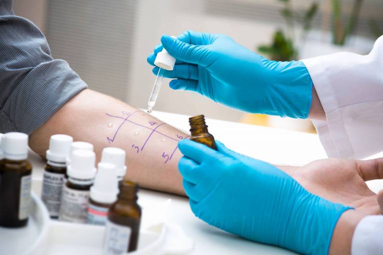Read more about the article Asthme sévère : Antécédents médicaux et tests