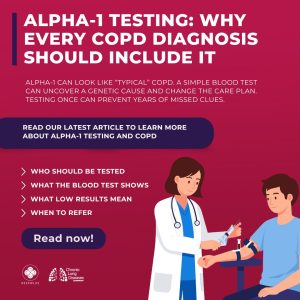 Alpha-1 Testing