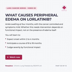 Peripheral Edema Lorlatinib