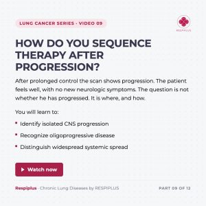 Sequencing After Progression in ALK+ Disease