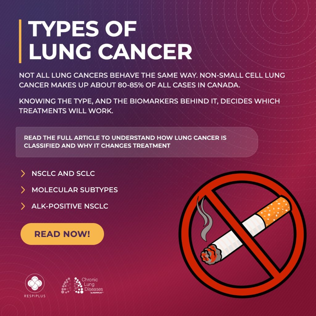 types of lung cancer