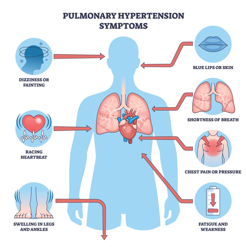 what is pulmonary arterial hypertension